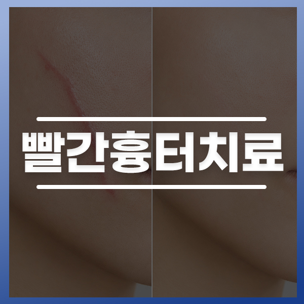 KakaoTalk_20260612_174842820_01.jpg