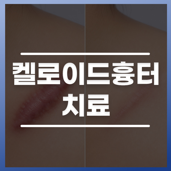 KakaoTalk_20260612_174842820_03.jpg