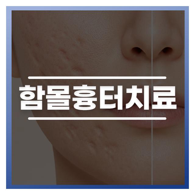 함몰흉터치료 전문의의 차별화된 노하우로 통증은 줄이고 결과는 만족스럽게